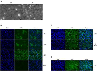 Susceptibility of primary ovine dorsal soft palate and palatine tonsil cells to FMDV infection